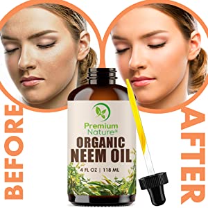 Our Neem Oil is the highest quality cold-pressed oil and provides many benefits