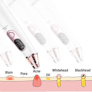 Electric Pore Suction