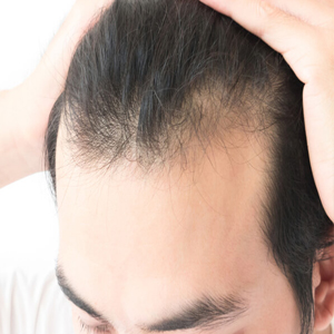 anti hair loss shampoo hair growing shampoo for men hair shampoo for hair loss  shampoo thin hair