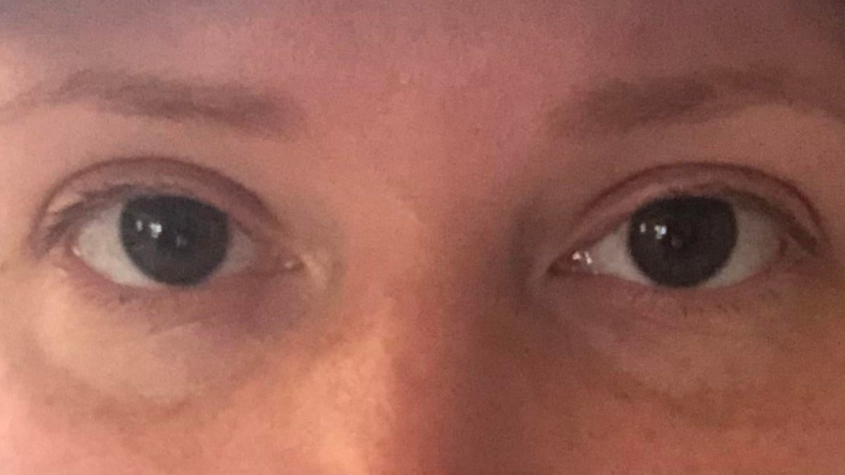 What is the shape of my eye?  I always thought hooded but I’m not sure