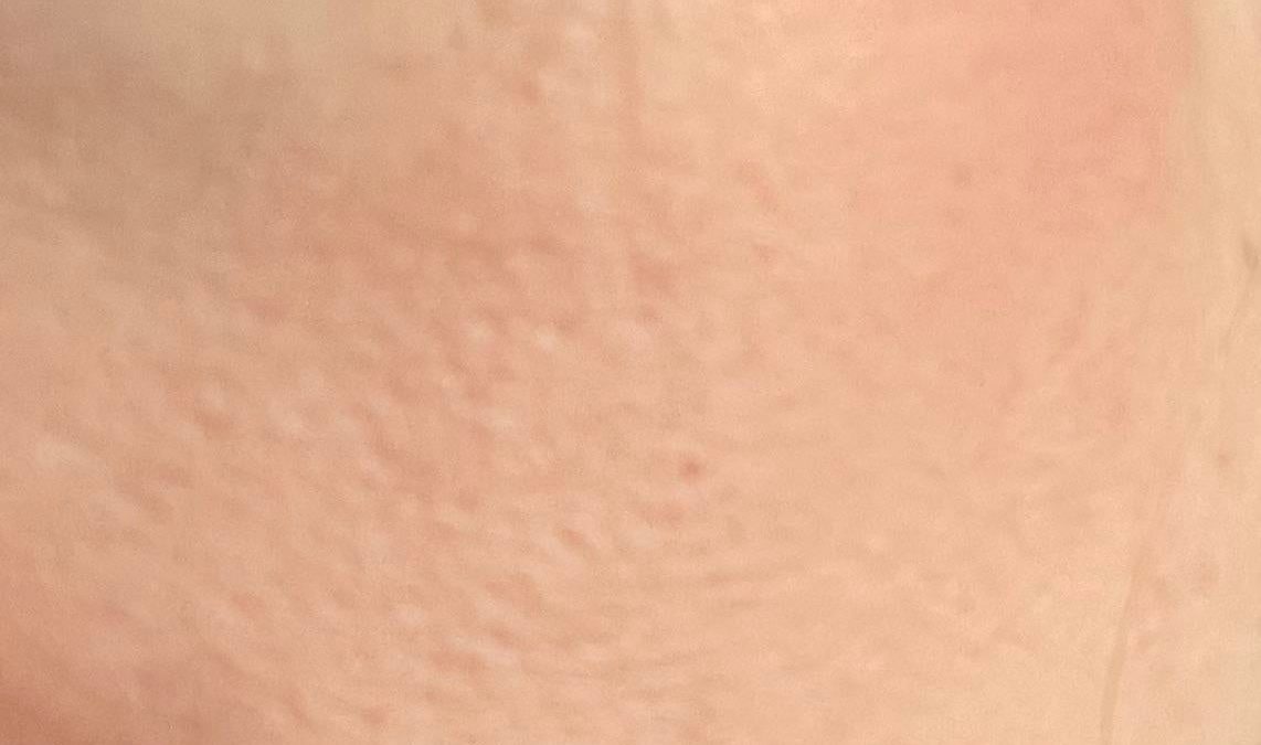 How do you avoid this kind of texturing on your cheeks?  The pores of my cheeks always show through my makeup and the older I get, the older I get.