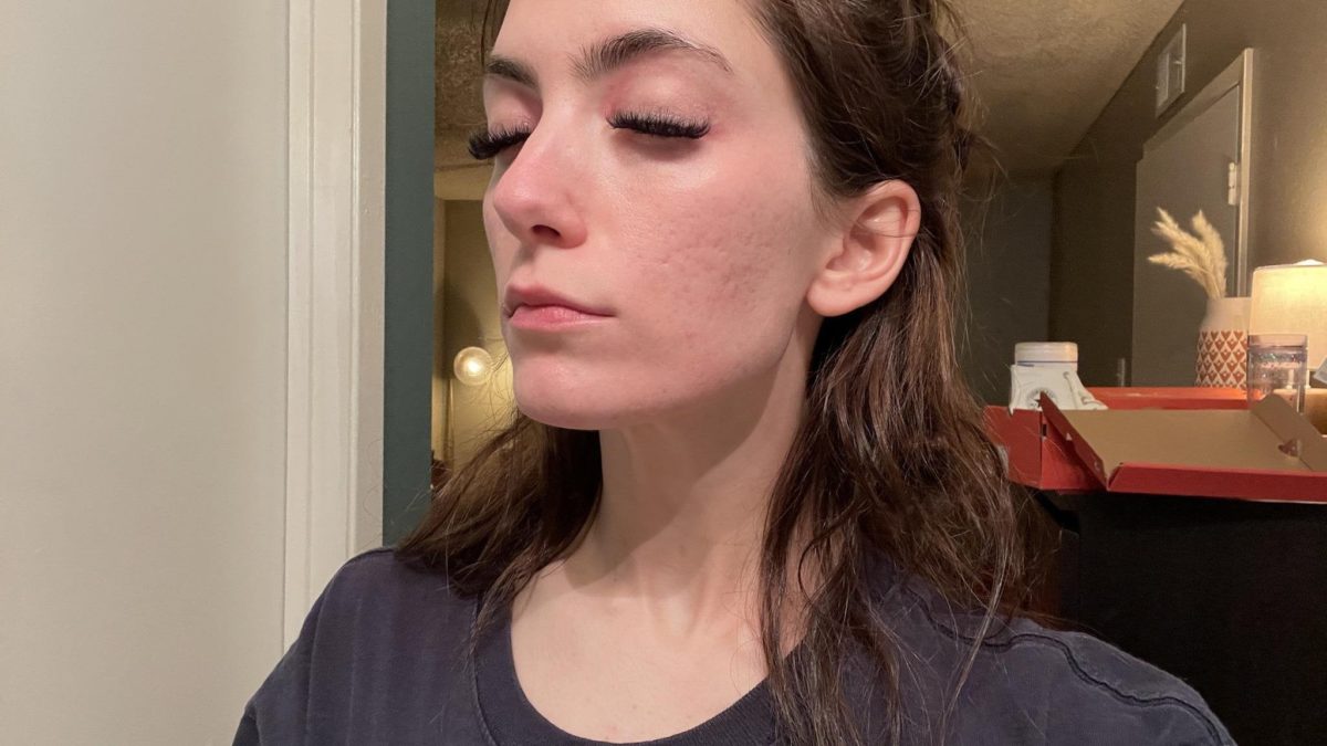 Hi!  I really need help finding a foundation for my specific skin problems / needs!